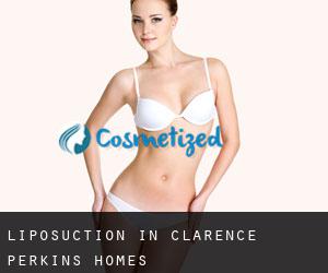 Liposuction in Clarence Perkins Homes