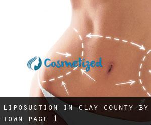 Liposuction in Clay County by town - page 1