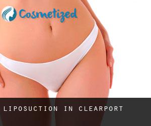 Liposuction in Clearport