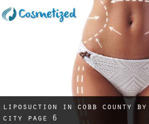 Liposuction in Cobb County by city - page 6