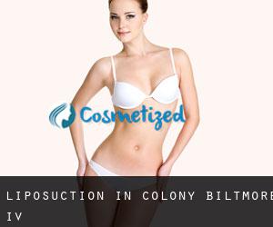 Liposuction in Colony Biltmore IV