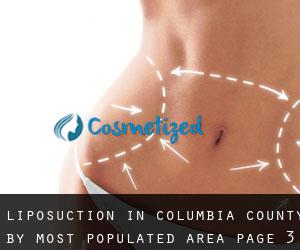 Liposuction in Columbia County by most populated area - page 3