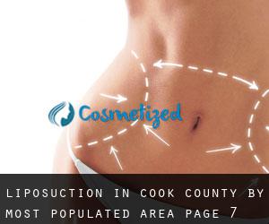 Liposuction in Cook County by most populated area - page 7