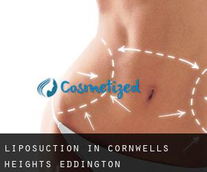 Liposuction in Cornwells Heights-Eddington
