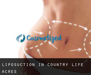 Liposuction in Country Life Acres