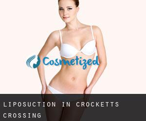 Liposuction in Crocketts Crossing