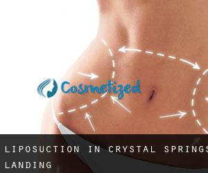 Liposuction in Crystal Springs Landing