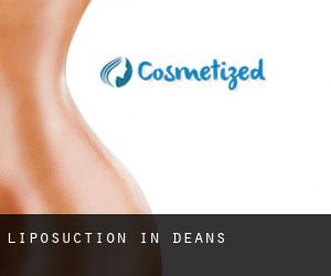 Liposuction in Deans