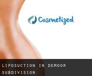 Liposuction in DeMoor Subdivision