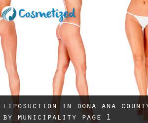 Liposuction in Doña Ana County by municipality - page 1