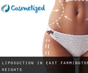 Liposuction in East Farmington Heights