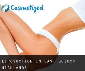 Liposuction in East Quincy Highlands