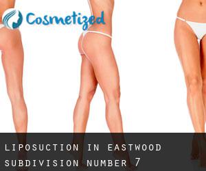 Liposuction in Eastwood Subdivision Number 7