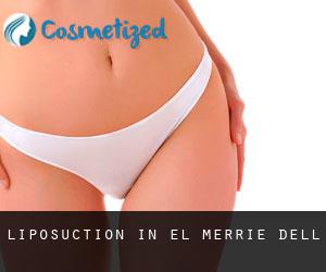 Liposuction in El Merrie Dell