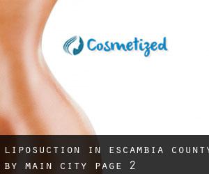 Liposuction in Escambia County by main city - page 2