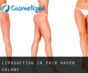 Liposuction in Fair Haven Colony