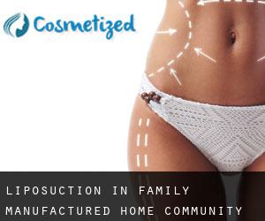 Liposuction in Family Manufactured Home Community