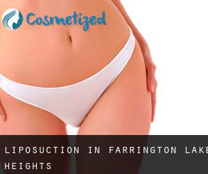Liposuction in Farrington Lake Heights