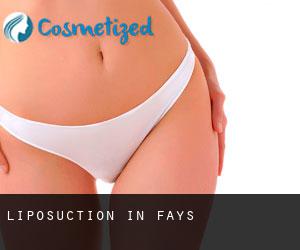 Liposuction in Fays