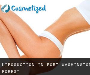 Liposuction in Fort Washington Forest
