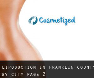 Liposuction in Franklin County by city - page 2