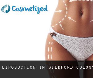 Liposuction in Gildford Colony