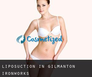 Liposuction in Gilmanton Ironworks