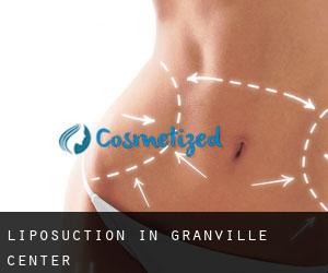 Liposuction in Granville Center