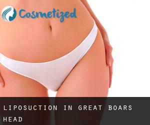 Liposuction in Great Boars Head