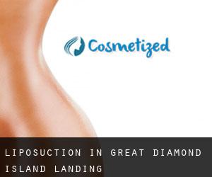 Liposuction in Great Diamond Island Landing