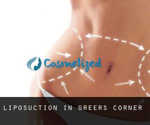 Liposuction in Greers Corner