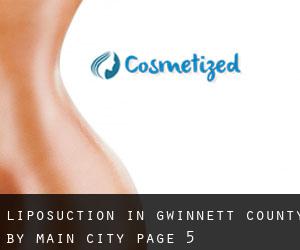 Liposuction in Gwinnett County by main city - page 5