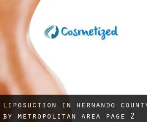 Liposuction in Hernando County by metropolitan area - page 2