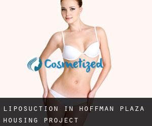 Liposuction in Hoffman Plaza Housing Project