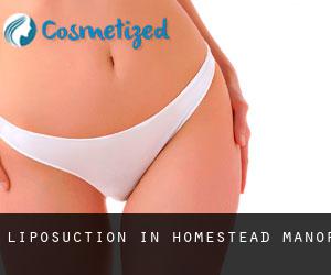 Liposuction in Homestead Manor
