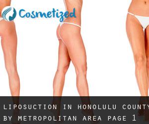 Liposuction in Honolulu County by metropolitan area - page 1