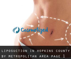 Liposuction in Hopkins County by metropolitan area - page 1