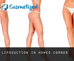 Liposuction in Howes Corner