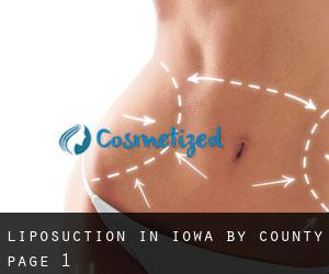Liposuction in Iowa by County - page 1