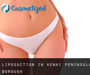 Liposuction in Kenai Peninsula Borough