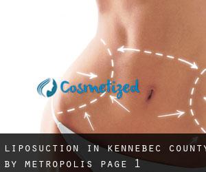 Liposuction in Kennebec County by metropolis - page 1