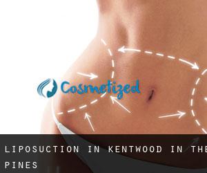 Liposuction in Kentwood-In-The-Pines