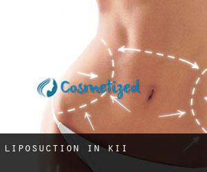 Liposuction in Ki‘i