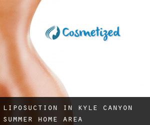 Liposuction in Kyle Canyon Summer Home Area