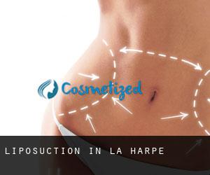 Liposuction in La Harpe