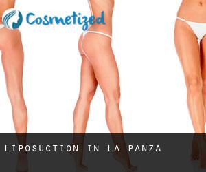 Liposuction in La Panza