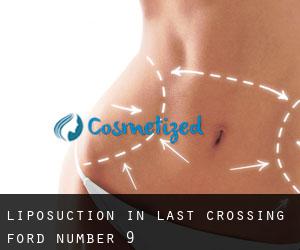 Liposuction in Last Crossing Ford Number 9