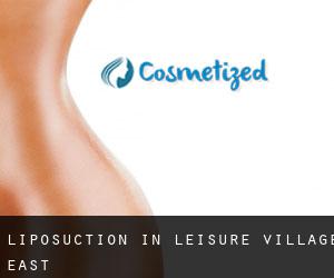 Liposuction in Leisure Village East