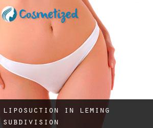 Liposuction in Leming Subdivision