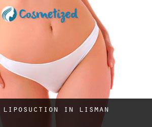 Liposuction in Lisman